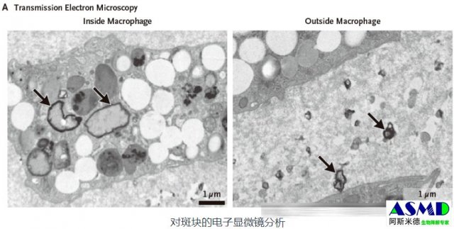 研究发现微塑料进入动脉或增加心脏病等风险